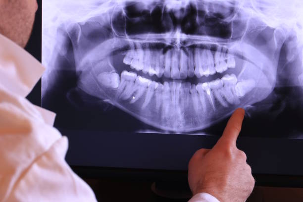 Best Emergency Cosmetic Dentistry in Macon, GA
