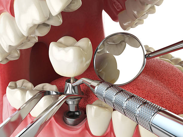 Best Mobile Emergency Dentist in Macon, GA
